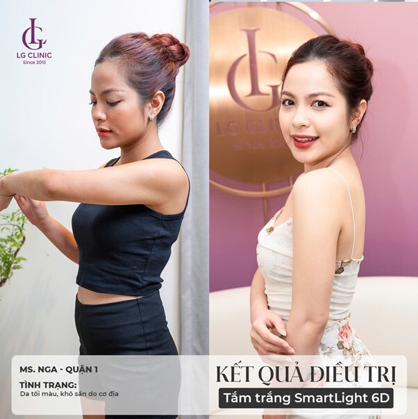 tắm trắng