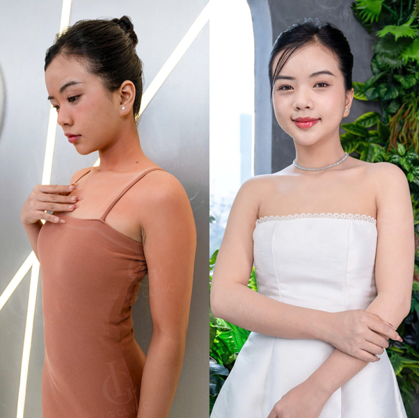 tắm trắng